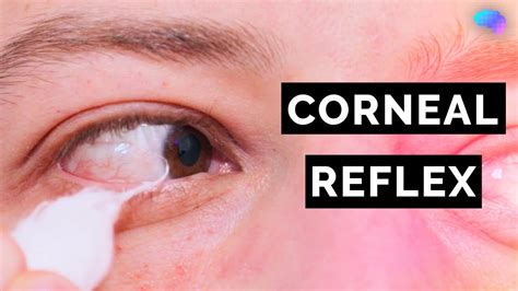 Corneal Reflex: Function, Assessment, and Clinical Significance.